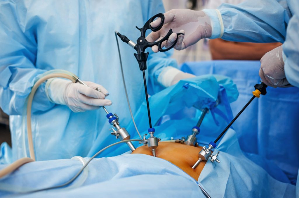 LAPAROSCOPIC SURGERY IN NIGERIA