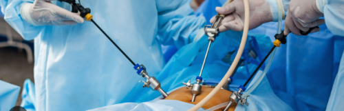 LAPAROSCOPIC SURGERY IN NIGERIA