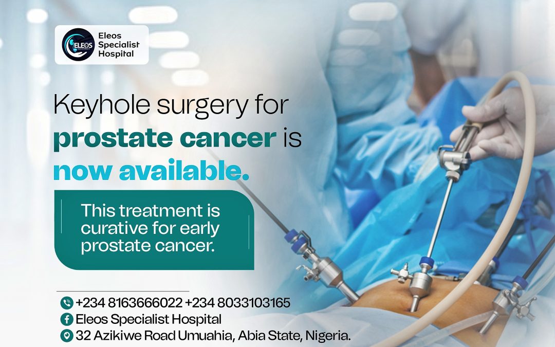 Prostate Cancer treatment in Nigeria