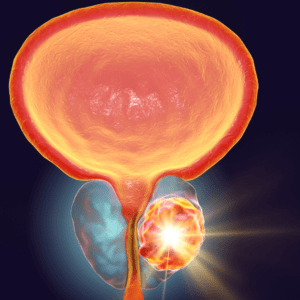 Where Can I Do ThuFLEP in Abuja? Best Hospitals for ThuFLEP Treatment in Abuja